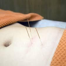 Unlocking the Power of Acupuncture: The Science Behind This Ancient Healing Technique