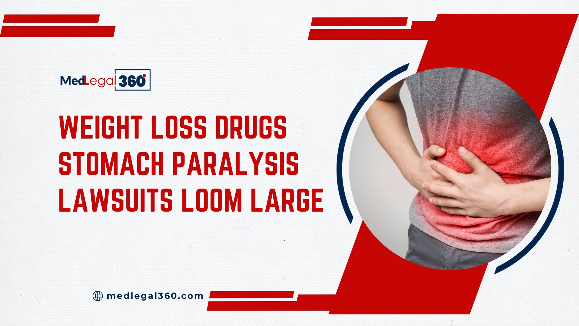 Weight Loss Drugs Stomach Paralysis Lawsuits November 2023 Updates