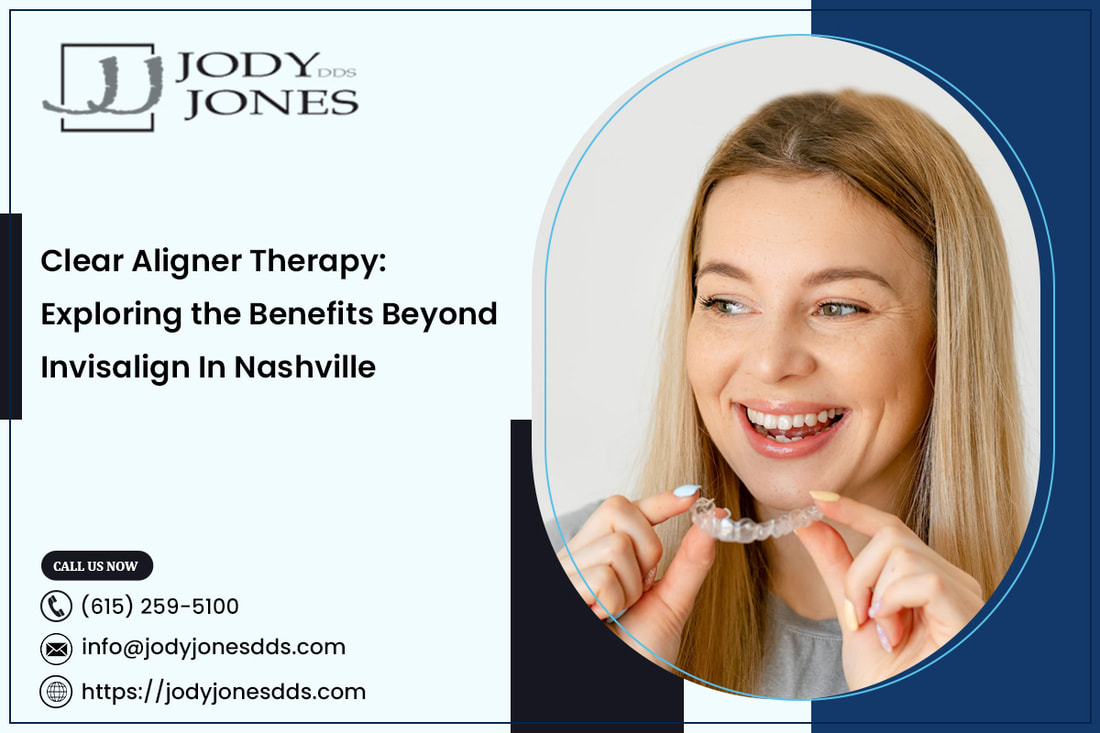 Clear Aligner Therapy: Exploring the Benefits Beyond Invisalign In Nashville - MY SITE