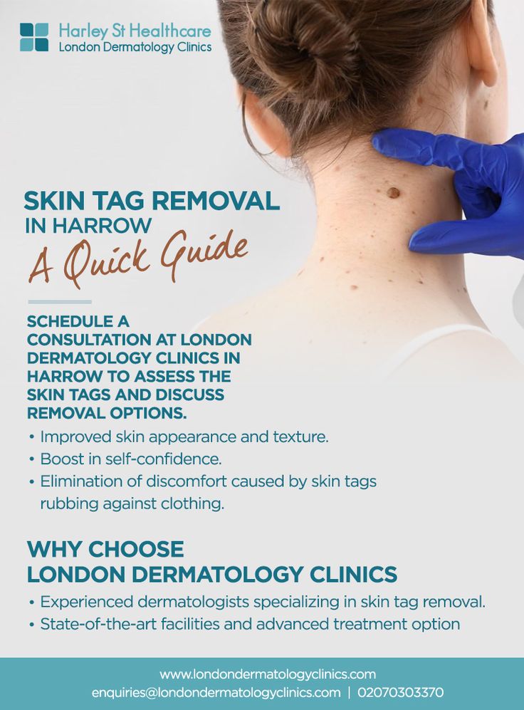 Pin on London Dermatology Clinics