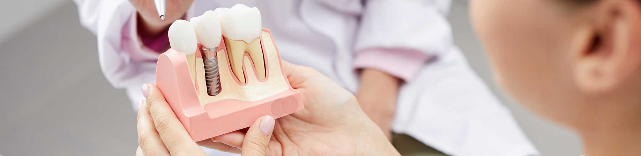 Dental Implants - DentisTree Dental Clinic