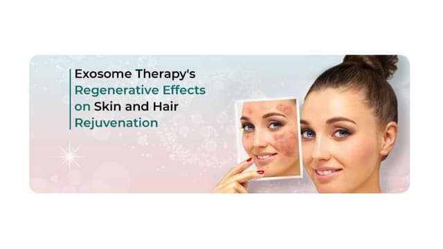 Exosome Therapy’s Regenerative Effects on Skin and Hair Rejuvenation | PPT