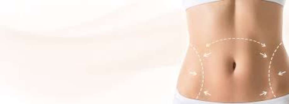 Liposuction Surgery Cover Image