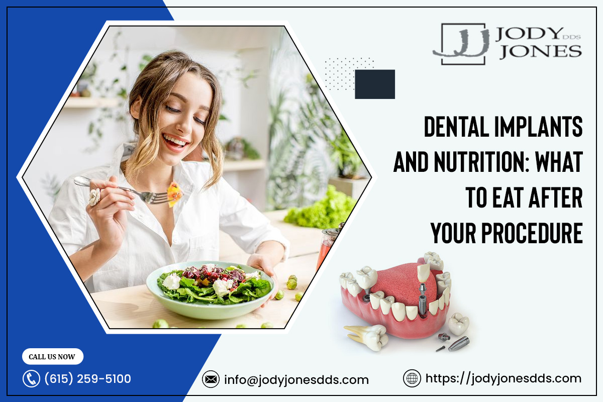 Dental Implants and Nutrition: What to Eat After Your Procedure – JODY JONES DDS