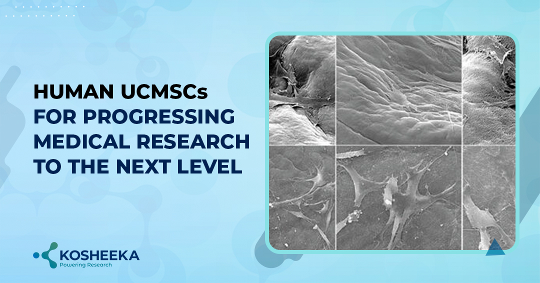 Human UCMSCs for progressing medical research to the next level | TechPlanet