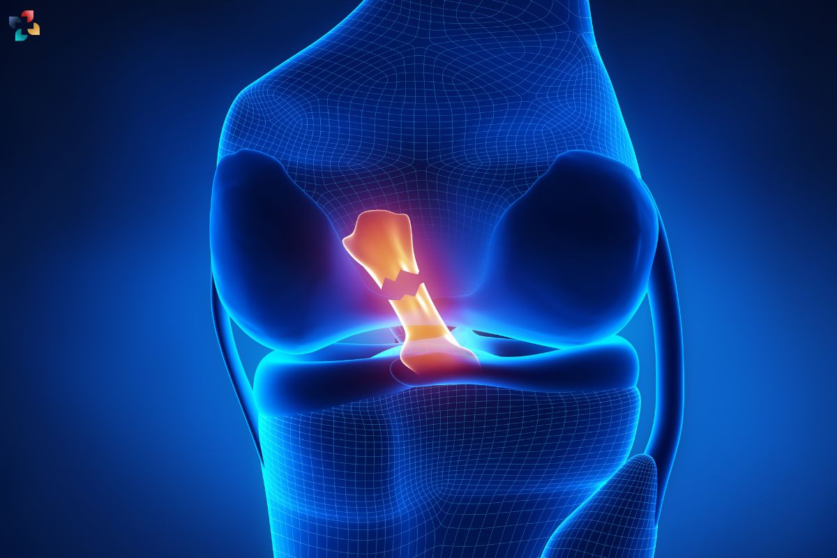 20 Effective Exercises For Meniscus Tear Rehab | The Lifesciences Magazine