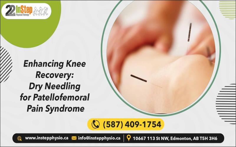 Enhancing Knee Recovery: Dry Needling for Patellofemoral Pain Syndrome - StylesRant