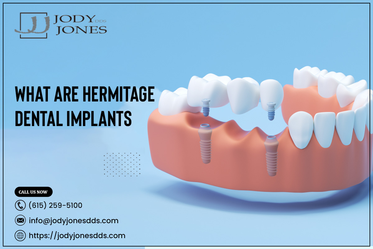 What Are Hermitage Dental Implants – JODY JONES DDS