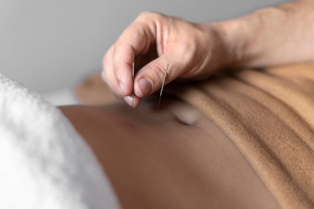 Experience Relief at The Best Acupuncture Treatment Clinic