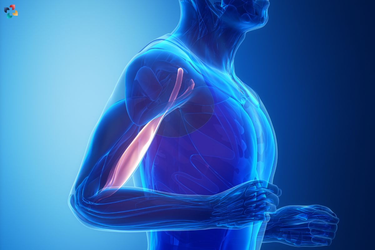 Distal Biceps Tendonitis: Causes, Symptoms, Diagnosis, And Treatment | The Lifesciences Magazine