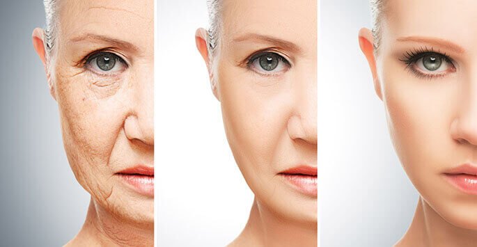 Find the Most Popular Anti-Aging Solutions