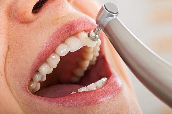 Why Is It Important To Have Consistent Teeth Cleanings And Checkups? | by Olde Town Dentistry | Aug, 2024 | Medium