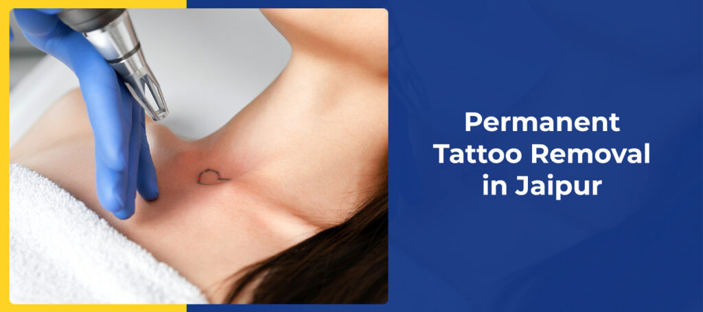 Safe and Effective Permanent Tattoo Removal in Rajasthan