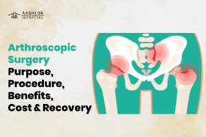 Arthroscopic Surgery: Purpose, Procedure, Benefits, Cost & Recovery