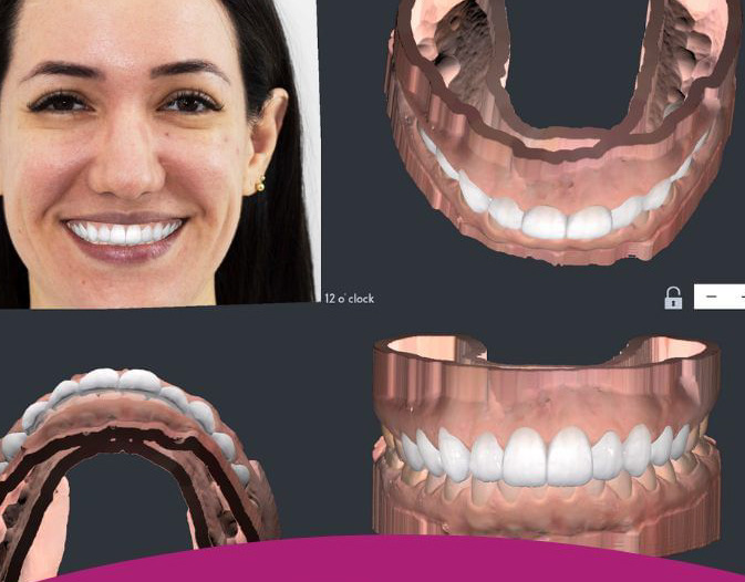 6 Key Tips for Optimizing Your Smile Simulation App