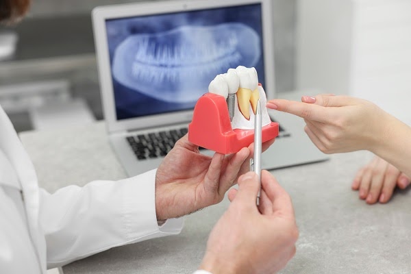 5 Signs You Might Be a Good Candidate for Dental Implants