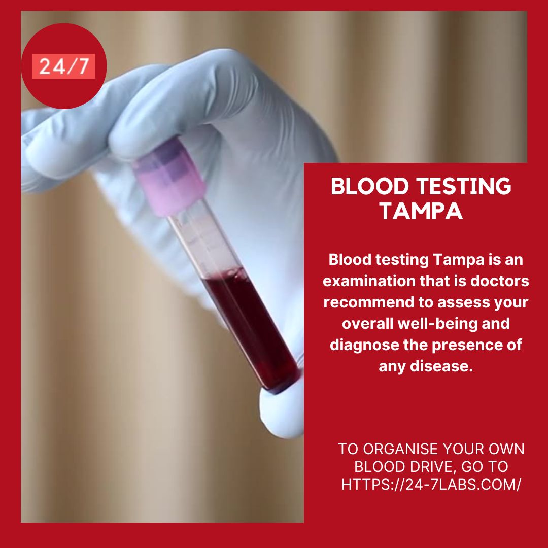 Blood Testing Tampa – The Methods & Detailed Procedure - ZuBeenPost