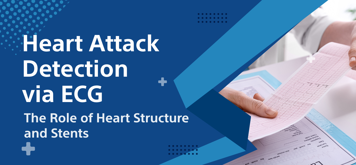 Heart Attack Detection via ECG: The Role of Heart Structure and Stents