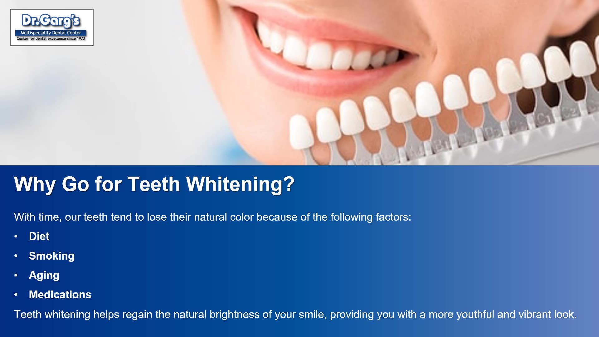 Teeth Whitening 101: Everything You Need to Know