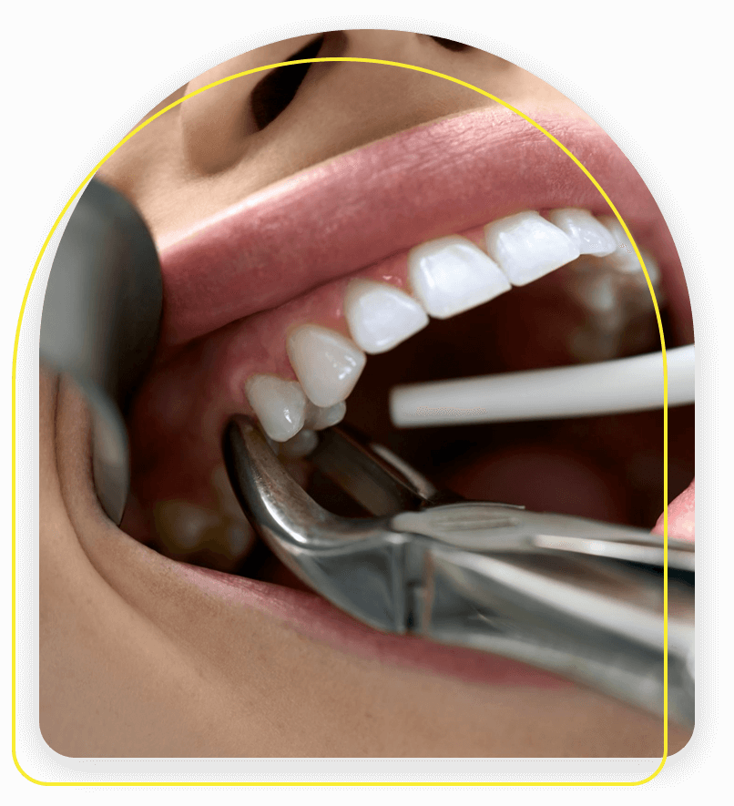 Oral Surgery | West Covina Dental