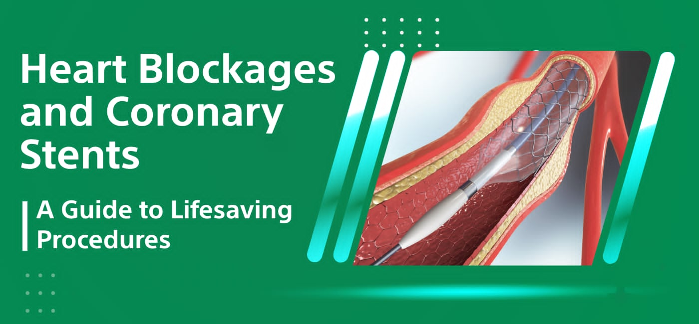 Heart Blockages and Coronary Stents: A Guide to Lifesaving Procedures - My Healthy Choice