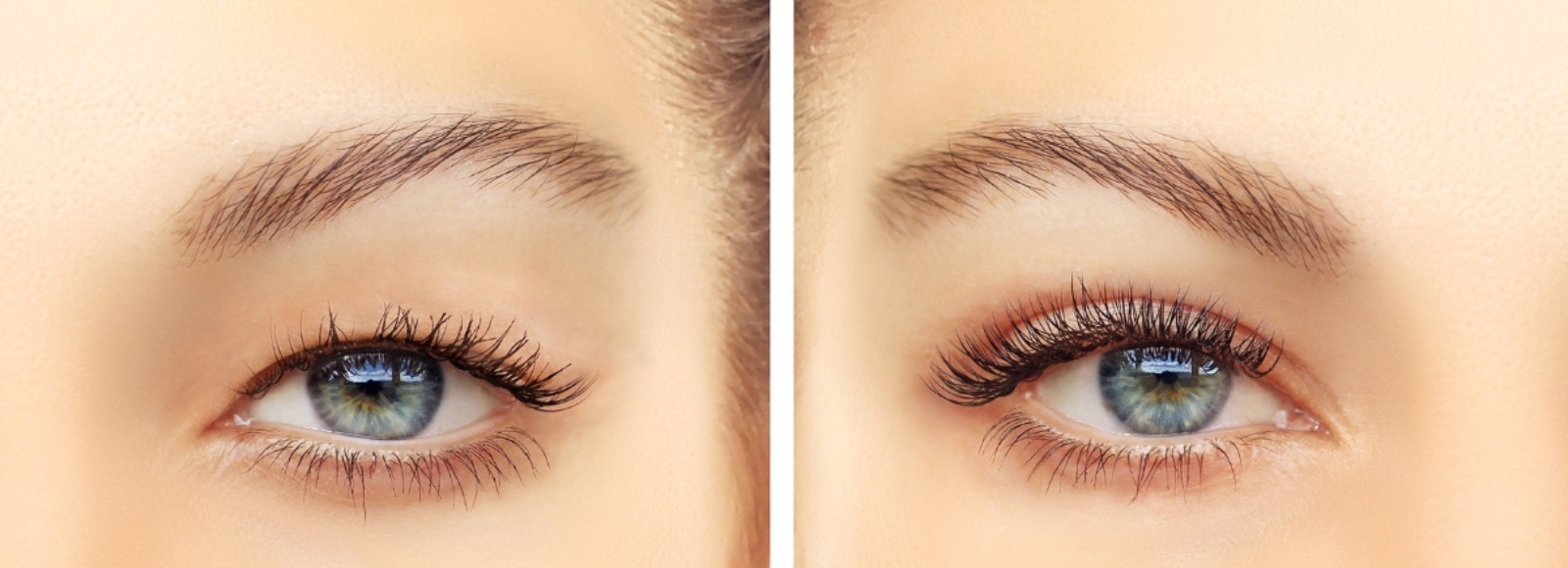 Eyelid Lift (Blepharoplasty) Surgery Los Angeles | Eyelid Lift Specialist