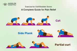 Exercise for Gall Bladder Stone: Complete Pain Relief Guide