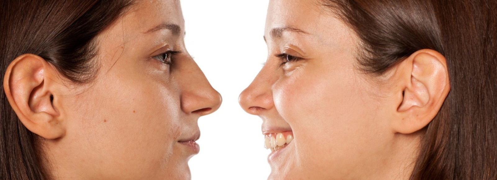 Rhinoplasty in Los Angeles | Nose Job by Dr. Jain In Los Angeles