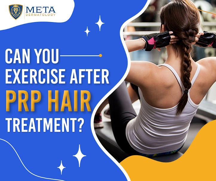 Can You Exercise After PRP Hair Treatment? Here's the Truth - Meta Dermatology