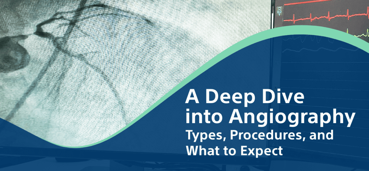 A Deep Dive into Angiography: Types, Procedures and What to Expect